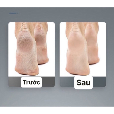 Dụng cụ cạo chân bằng thép không gỉ , để loại bỏ da chết , vết chai, , dụng cụ chà xát bàn chân, dao bào