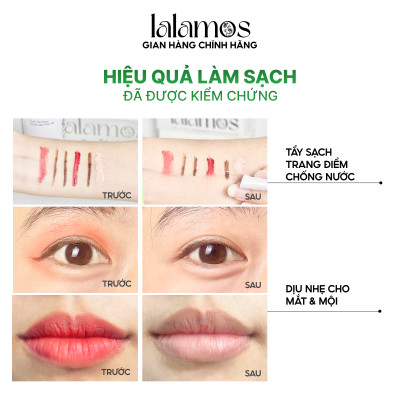 Combo sạch sâu Lalamos Nước tẩy trang 280ml + Sữa rửa mặt 280ml + Toner Kim Ngân Hoa 250ml